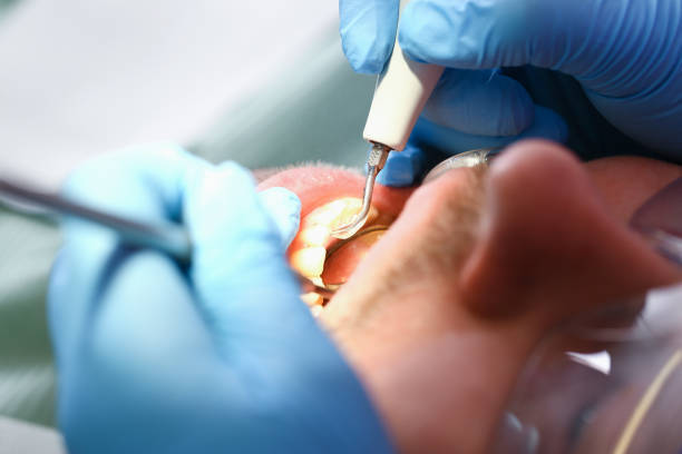 Best Emergency Root Canal Therapy in Elk City, OK