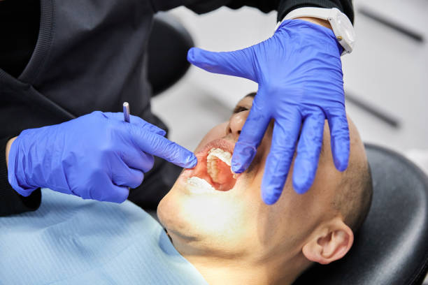 Best Dental Abscess Treatment in Elk City, OK